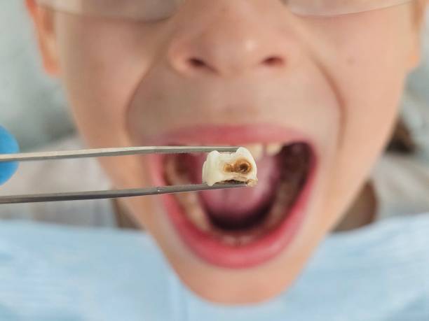 Best Emergency Root Canal Therapy in Pender, NE